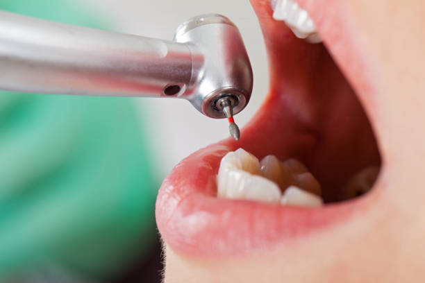 Best Pediatric Emergency Dentist in Summit, IL